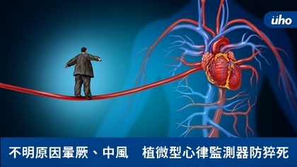 不明原因暈厥、中風　植微型心律監測器防猝死