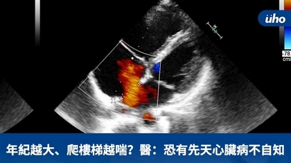 年紀越大、爬樓梯越喘？醫：恐有先天心臟病不自知